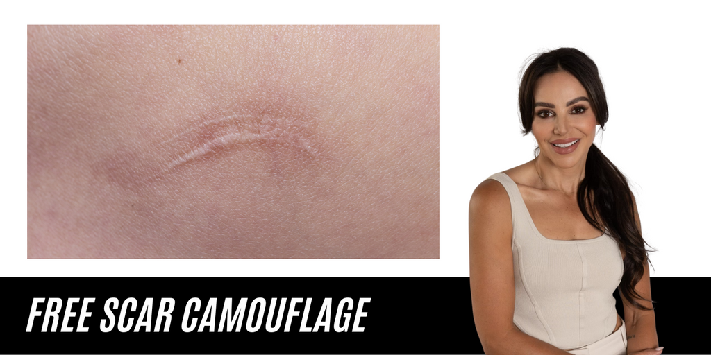 Skin Camouflage - Medicare Cosmetics