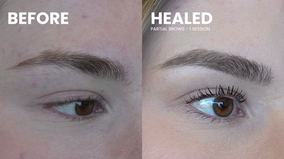 The Partial Brow Method