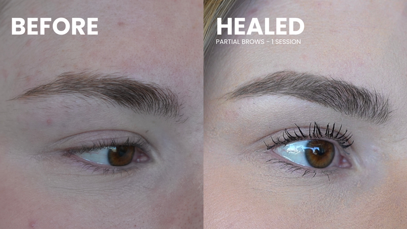 The Partial Brow Method