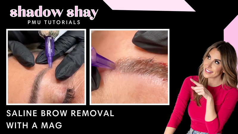 SHADOW SHAY 05: SALINE BROW REMOVAL WITH A MAG