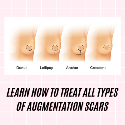 BREAST AUGMENTATION SCARS ONLINE